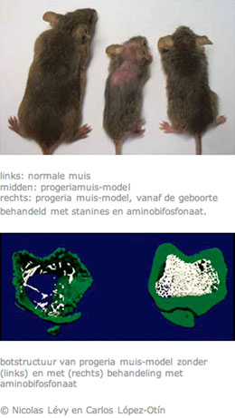 Tekstvak: ?links: normale muis?midden: progeriamuis-model ?rechts: progeria muis-model, vanaf de geboorte behandeld met stanines en aminobifosfonaat. ? ?botstructuur van progeria muis-model zonder (links) en met (rechts) behandeling met aminobifosfonaat? Nicolas Lvy en Carlos Lpez-Otn?